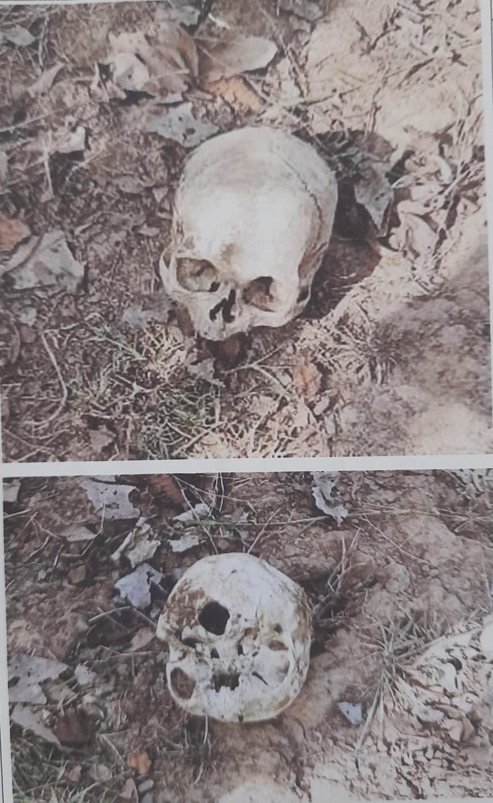 इटखेडा जंगलात मानवी कवटी आढळली